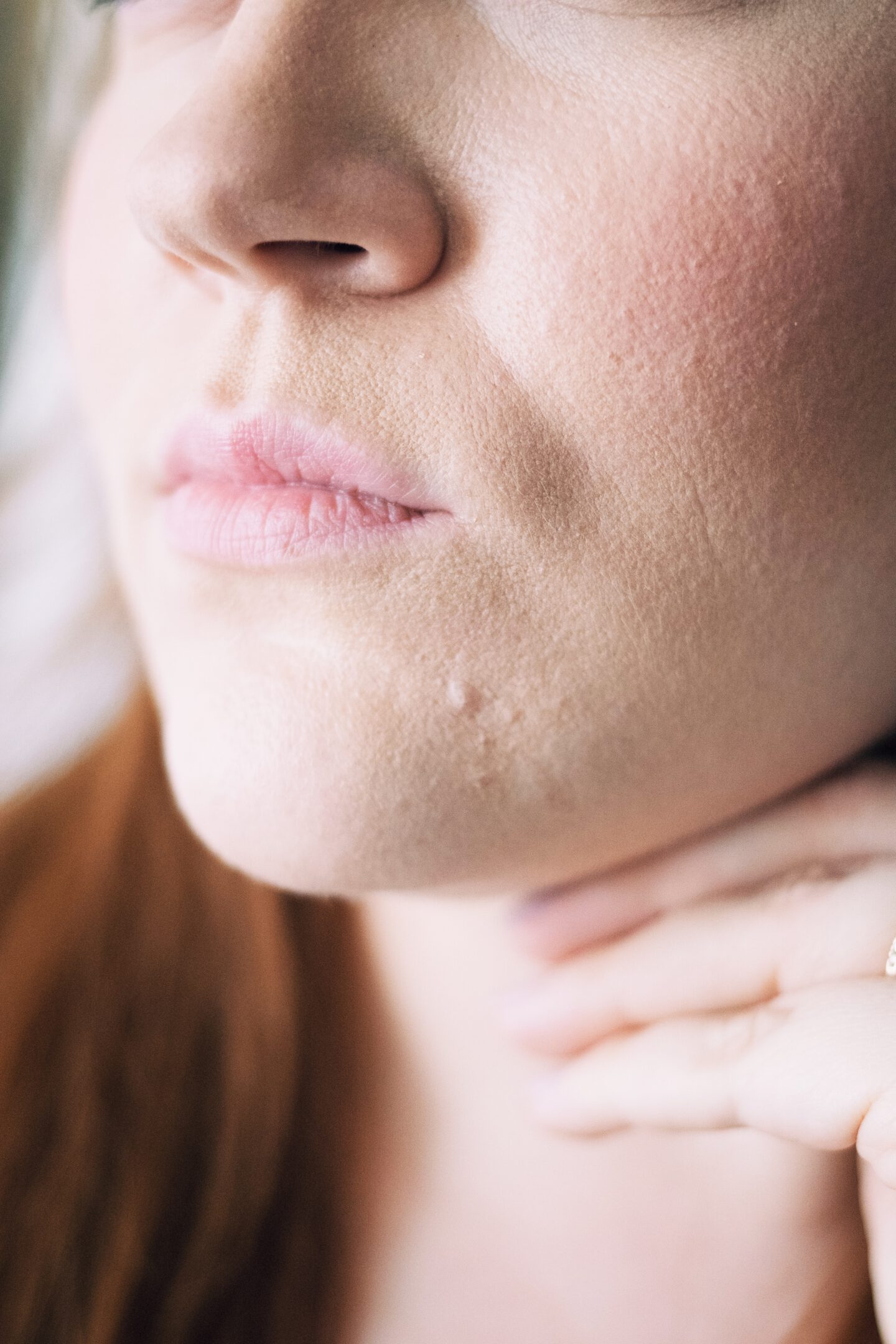 Maskne: Tipps gegen Hautprobleme durch die Mund-Nasen-Maske